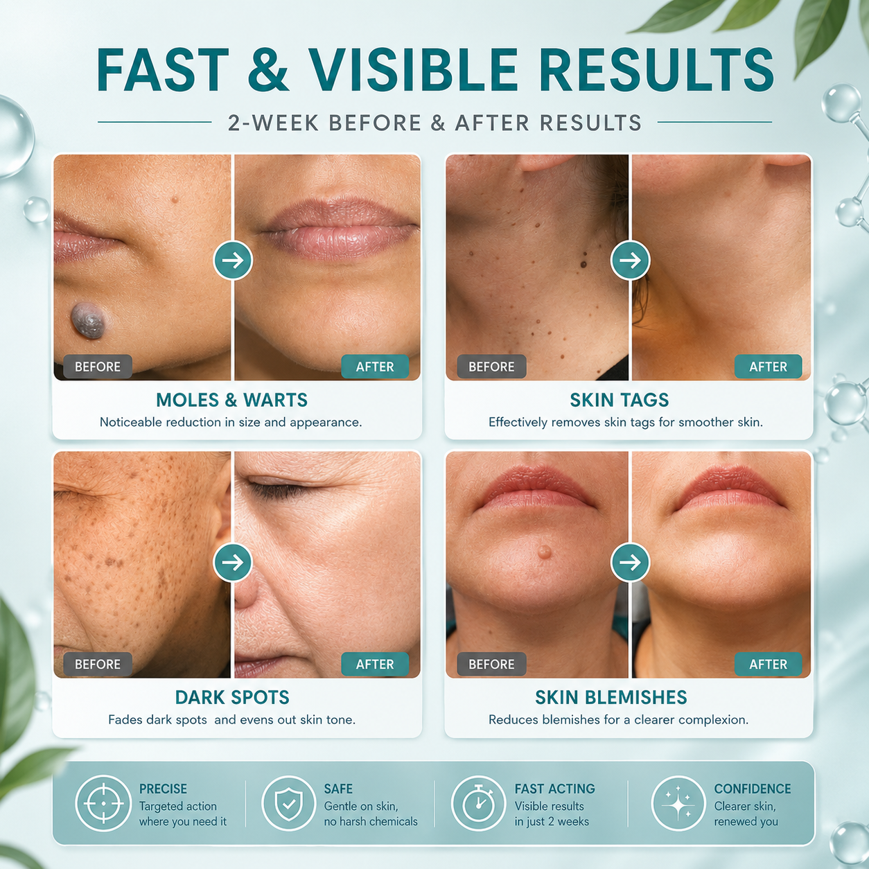 Xorita Non-Invasive Mole & Wart Removal Pen