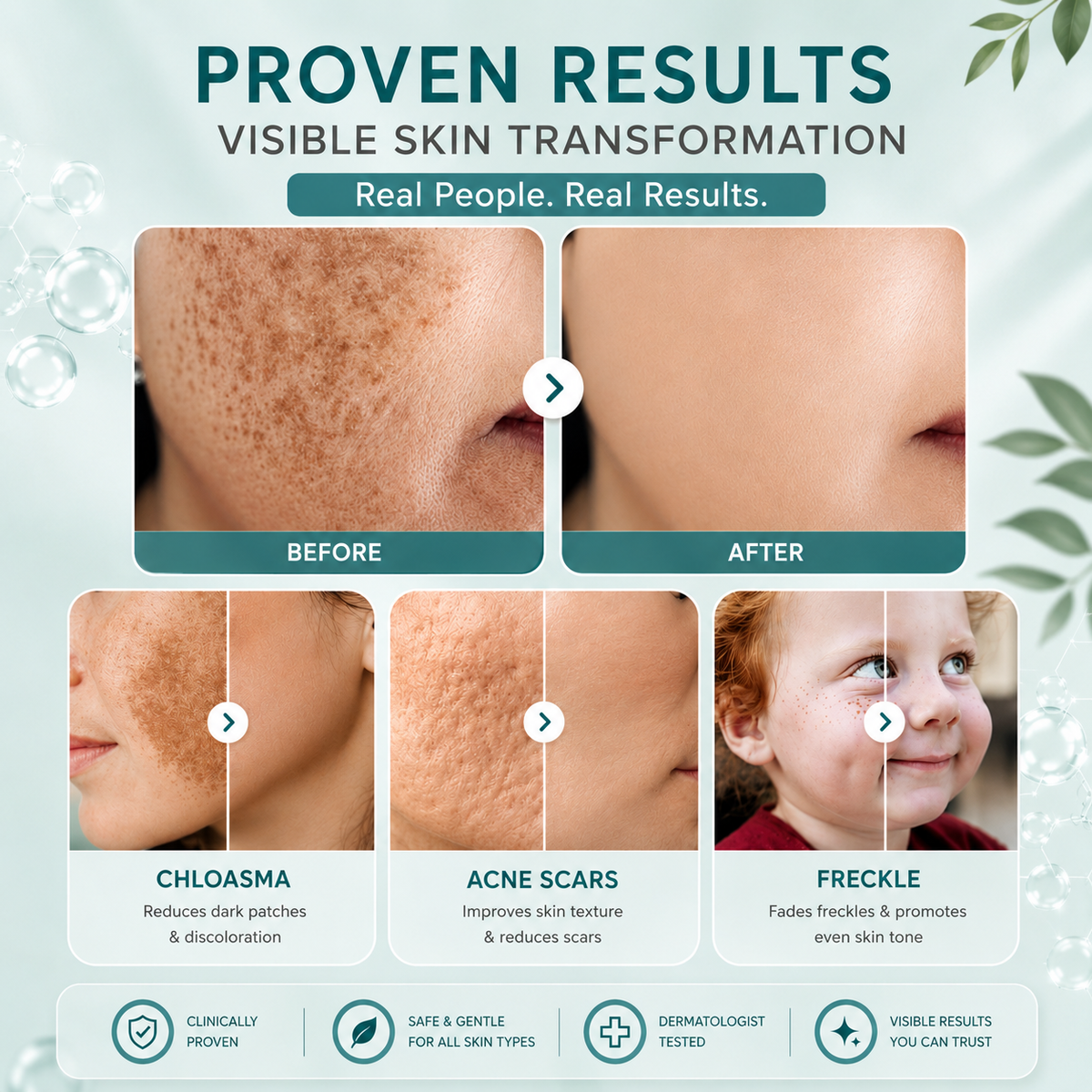Xorita Non-Invasive Mole & Wart Removal Pen