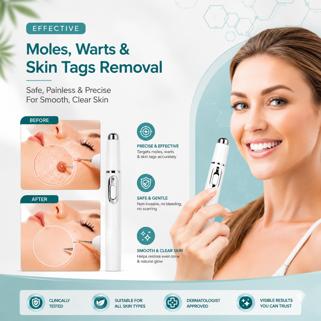 Xorita Non-Invasive Mole & Wart Removal Pen