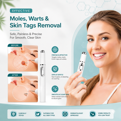 Xorita Non-Invasive Mole & Wart Removal Pen