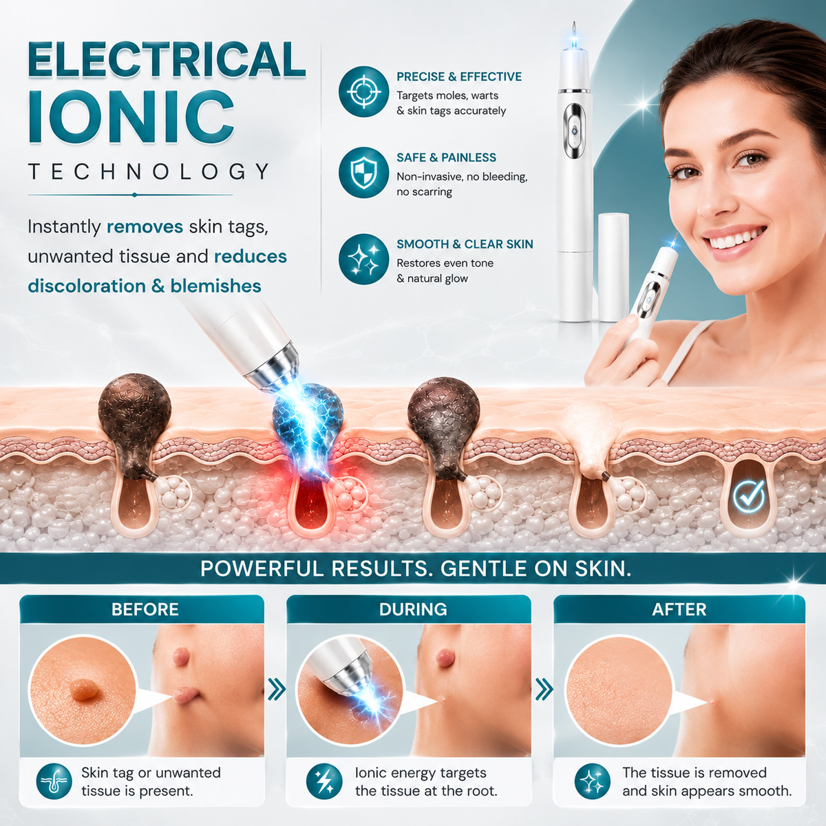 Xorita Non-Invasive Mole & Wart Removal Pen