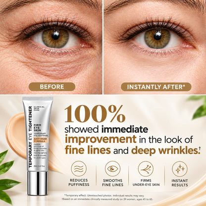 Instant Eye Lift – Under Eye Tightening Cream for Bags, Puffiness & Fine Lines